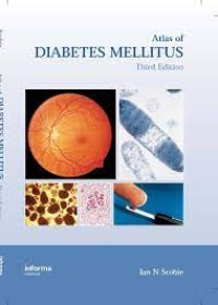 Image of E-Book TLM Atlas of Diabetes Mellitus